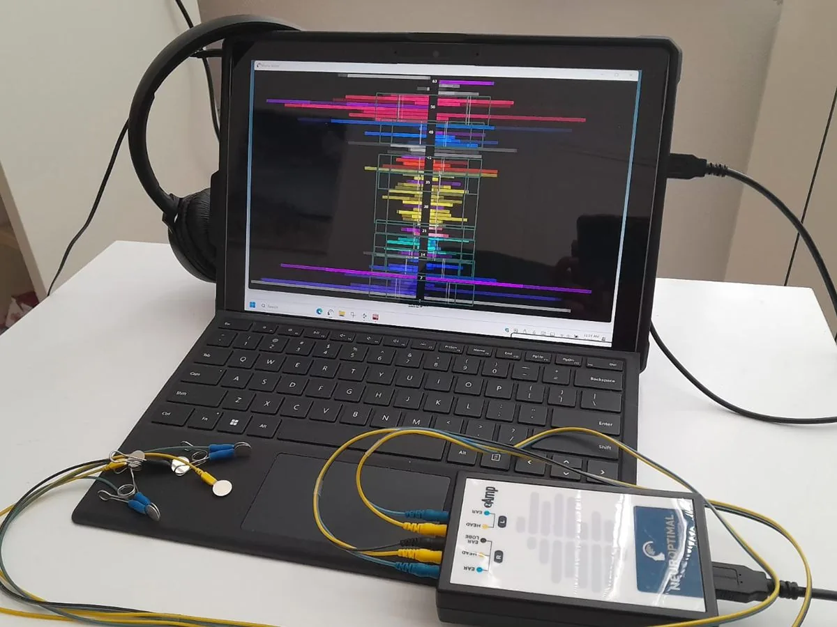 Le système NeurOptimal® : ordinateur affichant l'activité cérébrale, encodeur et capteurs posés sur la table